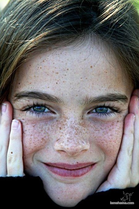 girl Freckled face