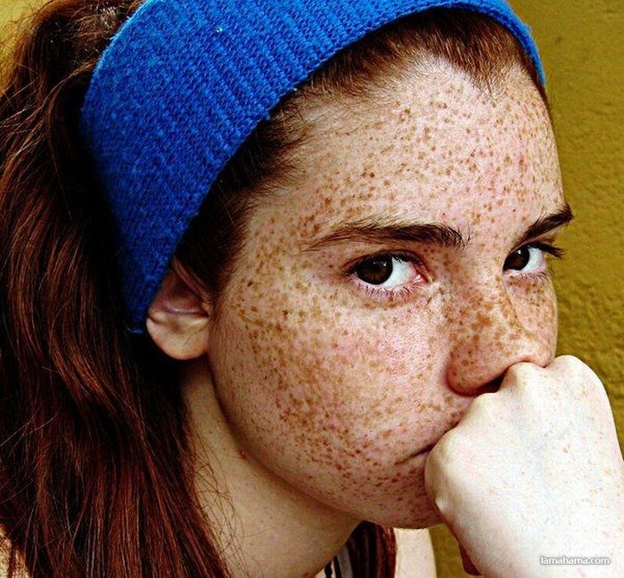Girls with freckles - Pictures nr 51