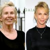 Stars without make-up - Pictures nr 53